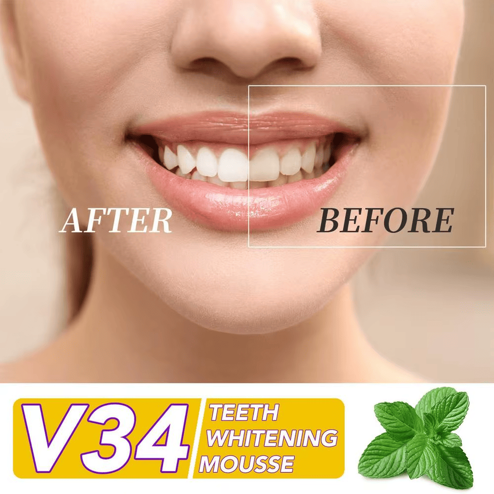 🔥 Hismile V34 - La Solución Definitiva Para Una Sonrisa Radiante 🔥