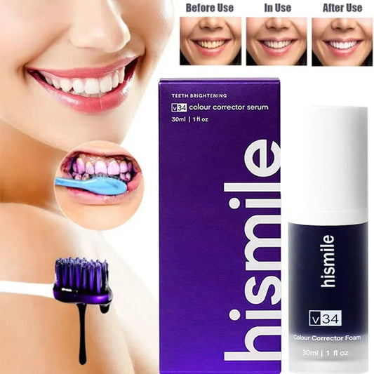🔥 Hismile V34 - La Solución Definitiva Para Una Sonrisa Radiante 🔥